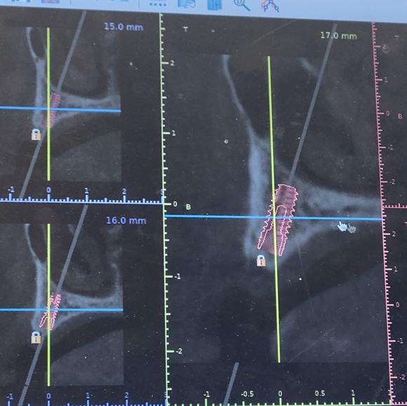 ⚠️Med.Photos ⚠️Warning - Picture 7 of 9